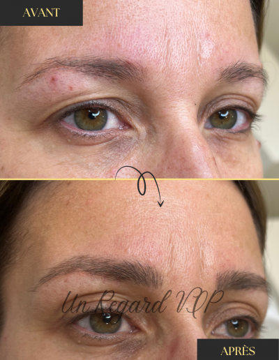 Microblading-UnRegardVIP-Client