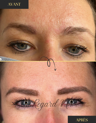 Microblading-UnRegardVIP-Clien