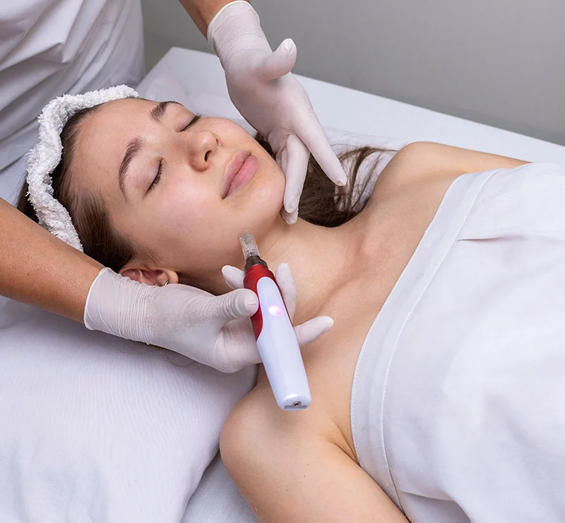 avantages du Dermaplaning 