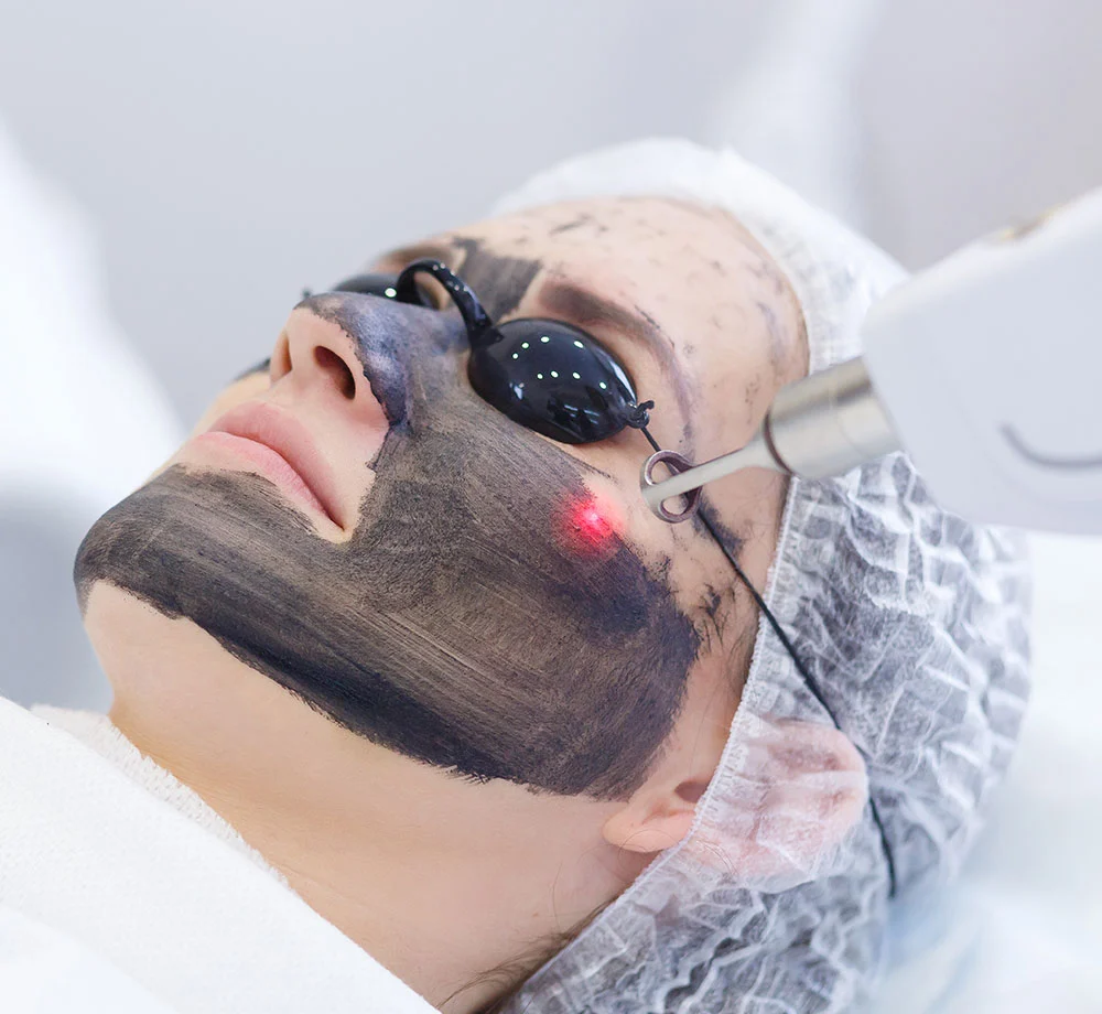 <br />
Comment se déroule une séance de Peeling Laser