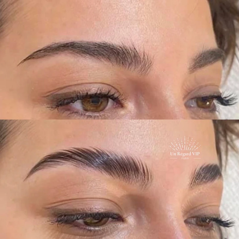 Brow Lift Un Regard VIP